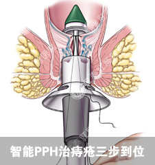 肛肠医师推荐