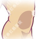 腹泻应重视，进行科学检查，防止疾病恶化!